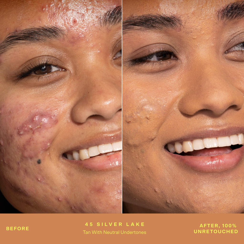 SunnyDays™ Tinted SPF 30