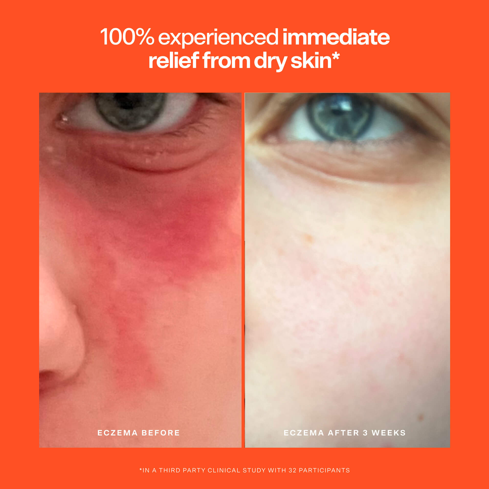 SOS Rescue Serum