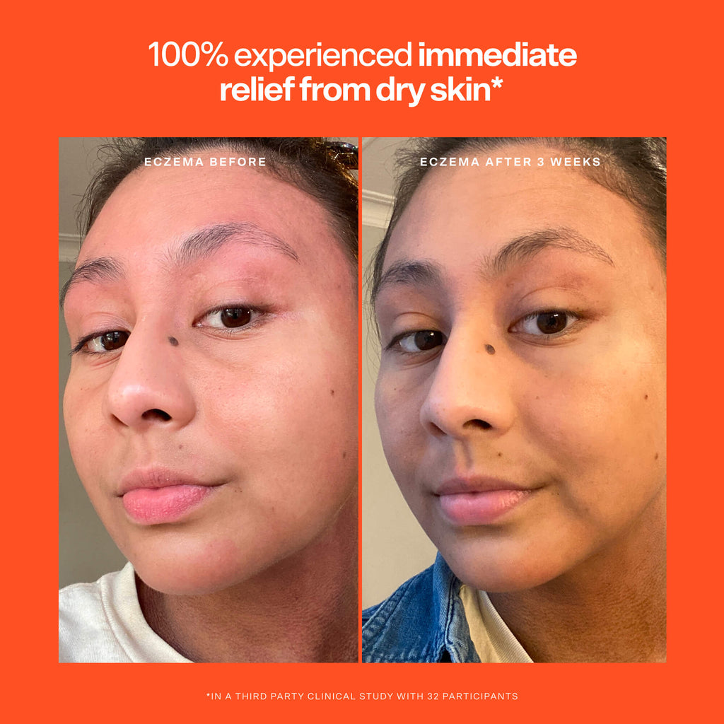 SOS Rescue Serum